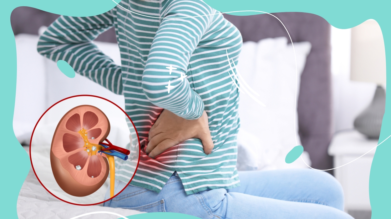 How Does A Woman Know She Passed A Kidney Stone