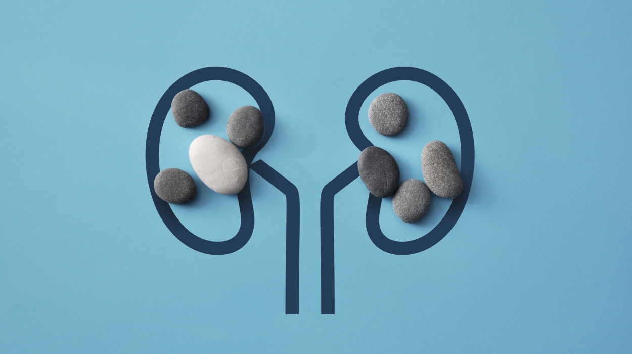 how to force a kidney stone to pass