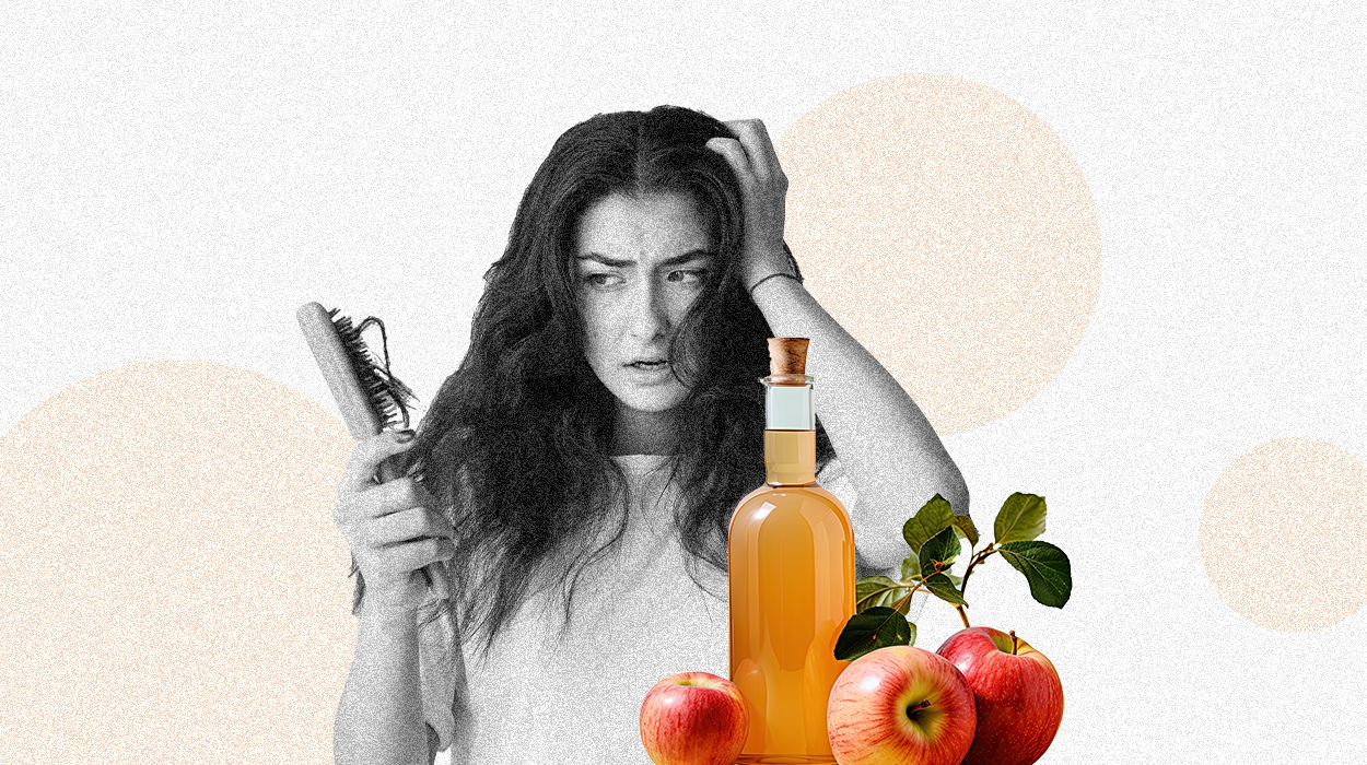 apple cider vinegar for dandruff